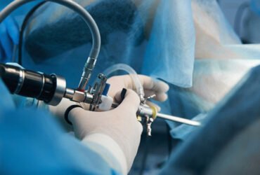 Laparoscopy Hysteroscopy