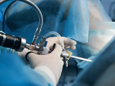 Laparoscopic Management