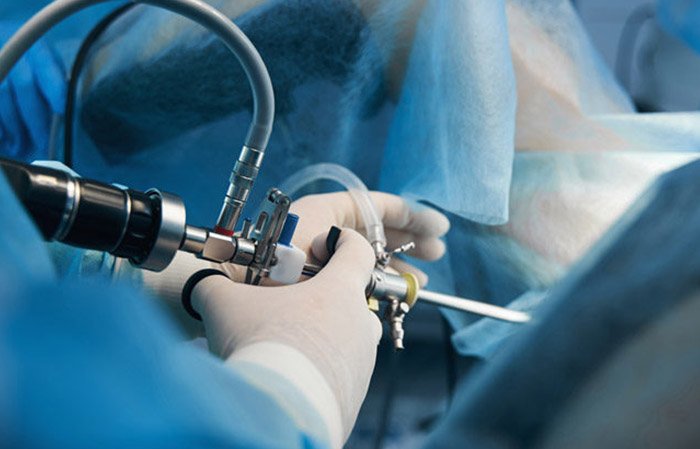 Laparoscopic Management