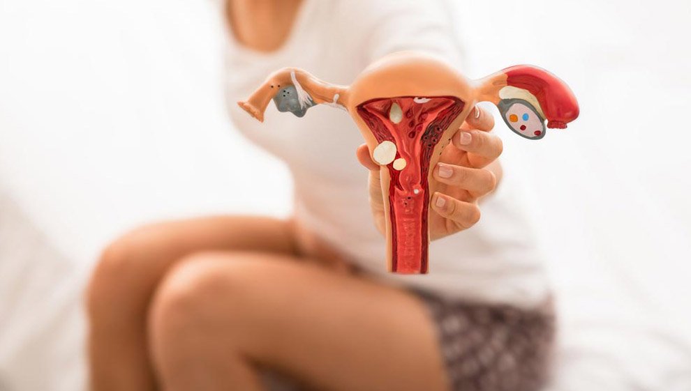 Expert Endometriosis Care by Dr. Arpana Jain in North Delhi